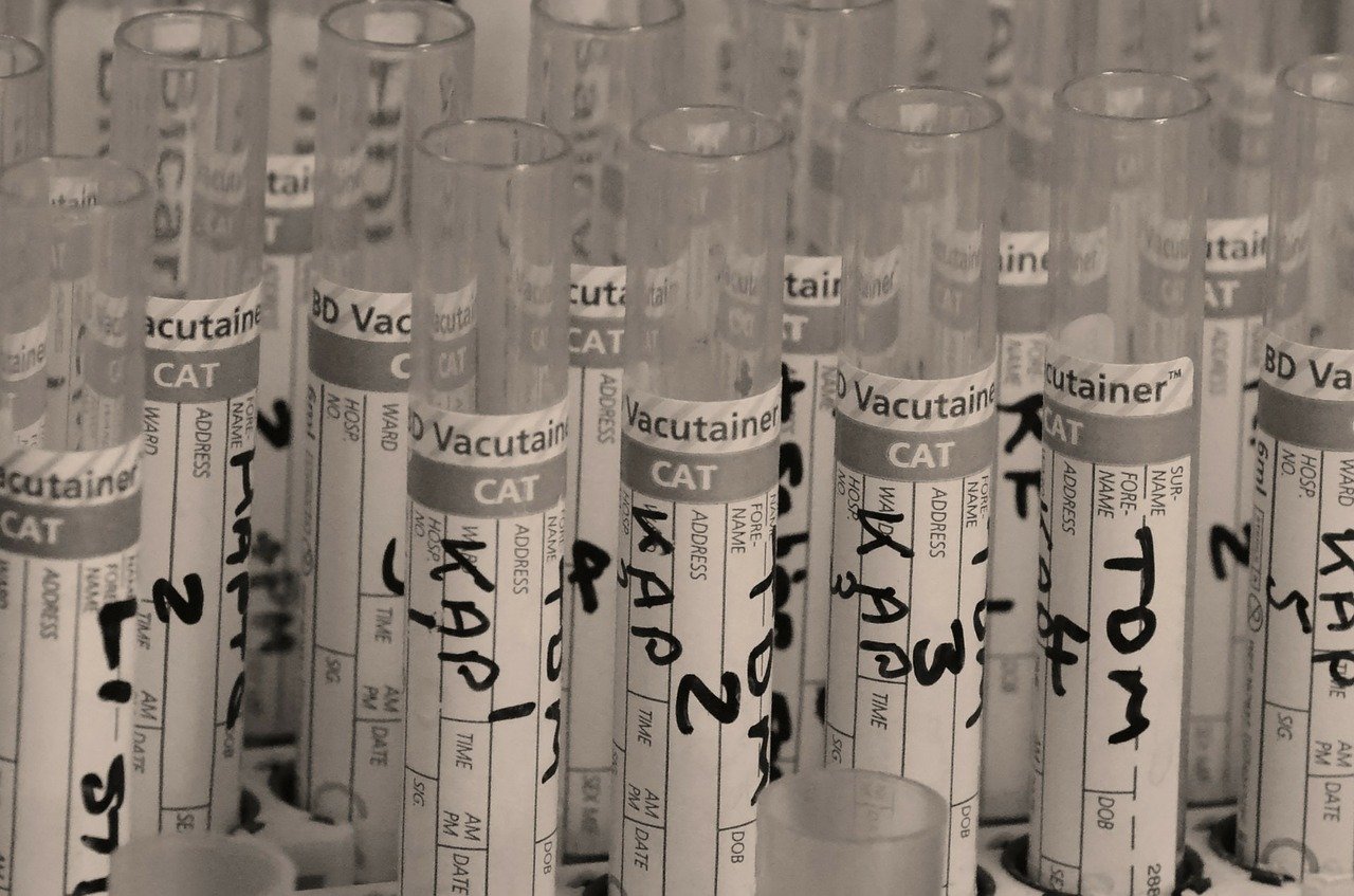 test, tube, lab